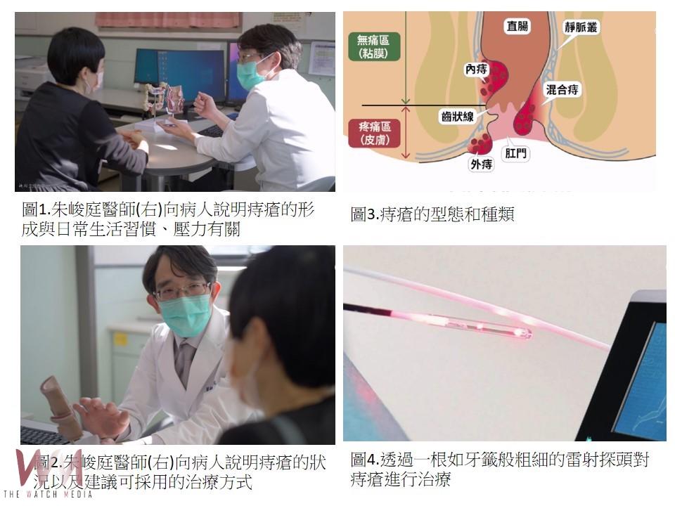 嘉基以先進「雷射消融術」　讓「痔」者重生擺脫困擾 - https://www.watchmedia01.com