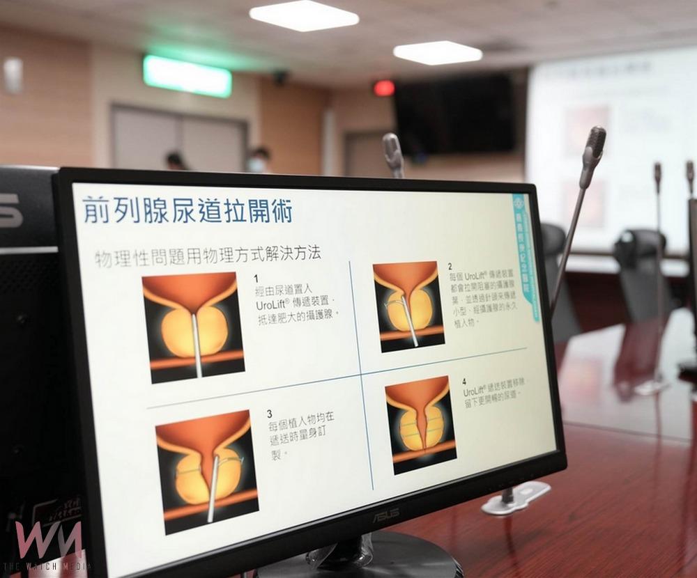 嘉義長庚引進微創攝護腺拉開手術UroLift療法 治療攝護腺肥大新選擇 - https://www.watchmedia01.com