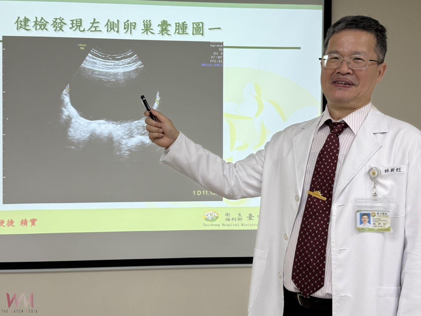 旅日前卵巢扭轉致腹痛掛急診　臺中醫院：緊急手術切除囊腫保卵巢 - https://www.watchmedia01.com