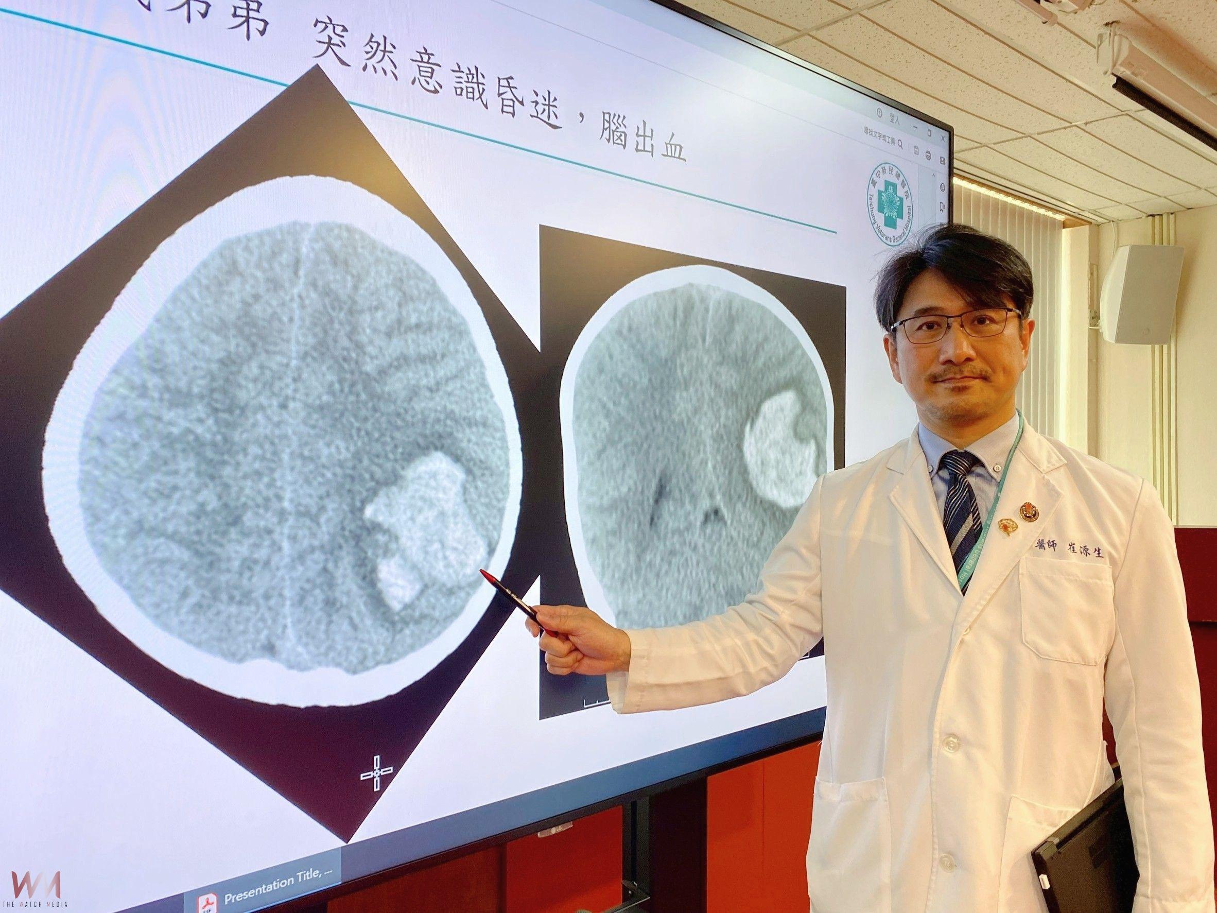 新式經靜脈血管造影術結合AR導航　臺中榮總精準腦內「拆彈」救童 - https://www.watchmedia01.com