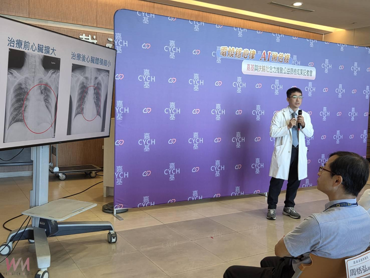 每15分鐘一人中風　AI初篩助早期發現心房顫動危機 - https://www.watchmedia01.com