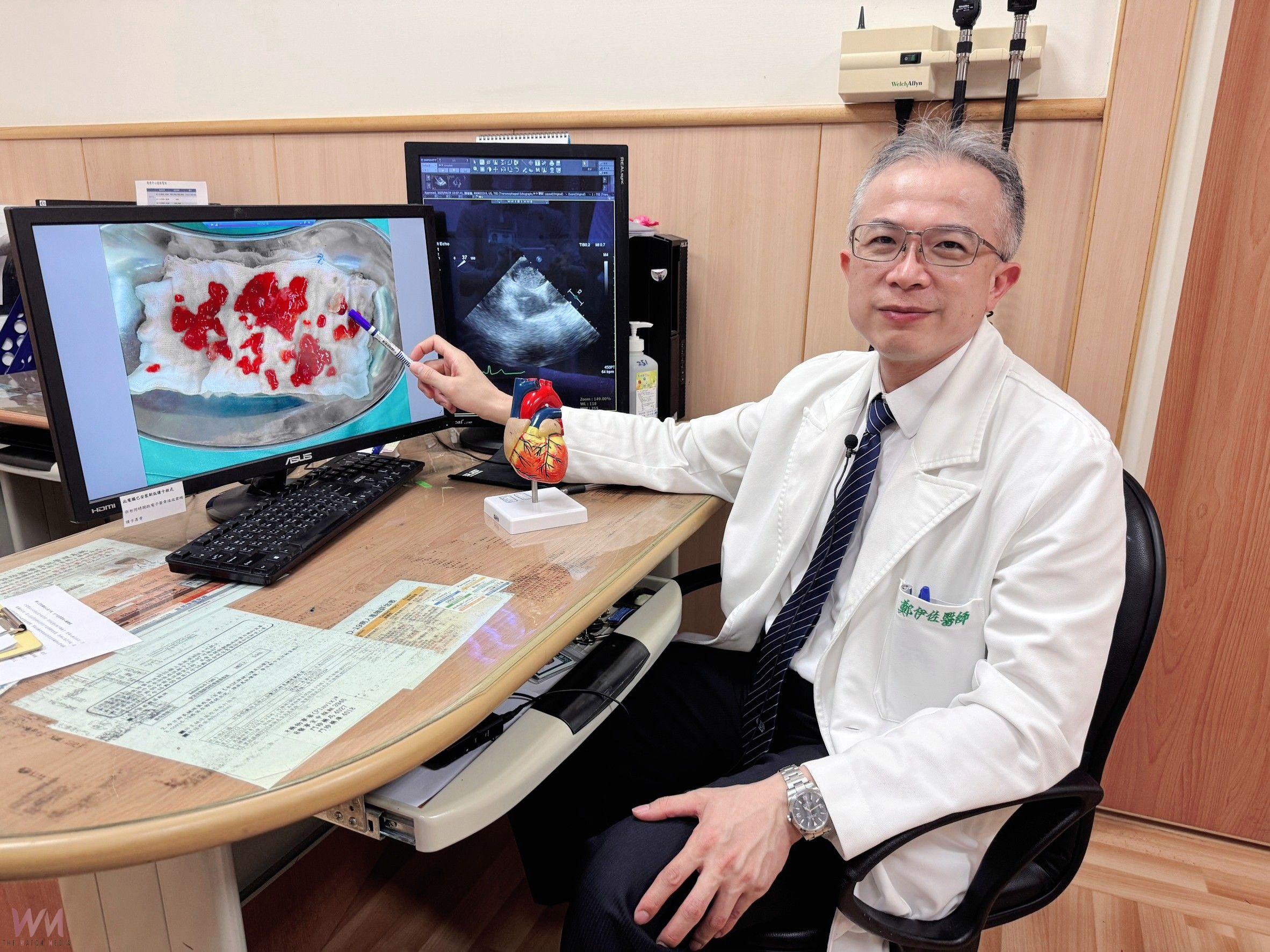 中風竟是心臟黏液瘤作怪　台中慈醫：６旬婦微創開心手術成功救命 - https://www.watchmedia01.com