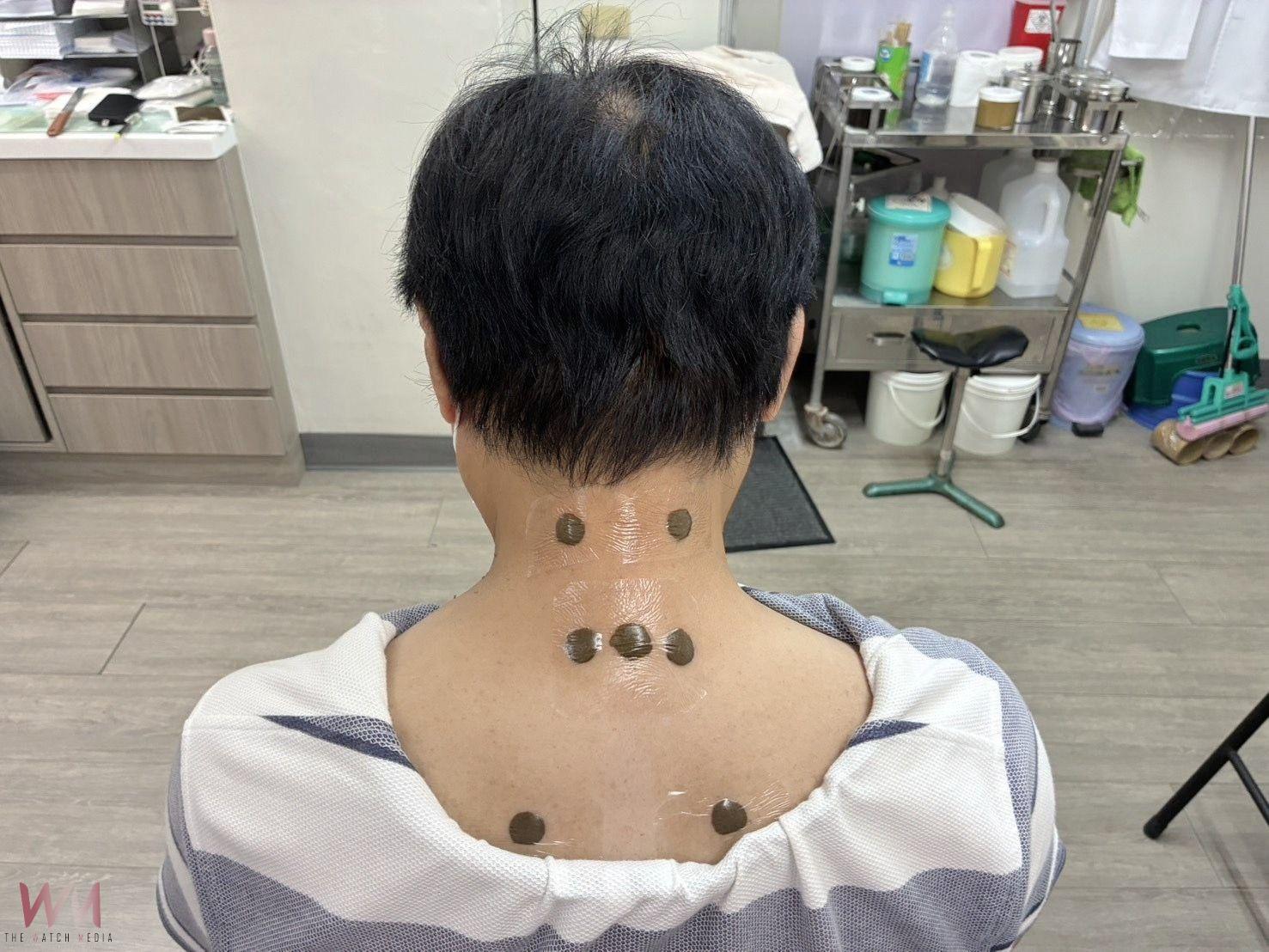 三伏貼不限三伏天　三伏貼敷療法提升免疫力 守護家人健康 - https://www.watchmedia01.com