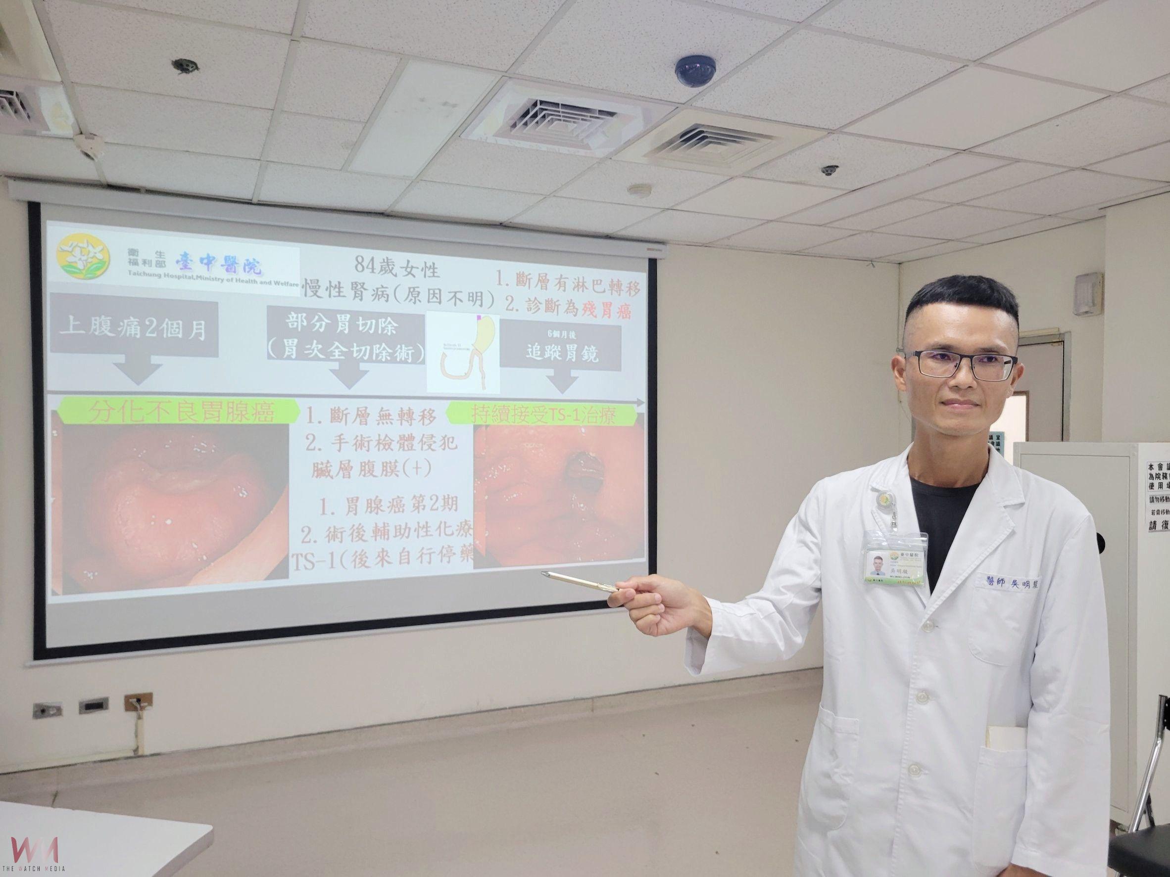 8旬婦胃癌切胃手術　不耐化療自行停藥致復發 又罹「殘胃癌」 - https://www.watchmedia01.com