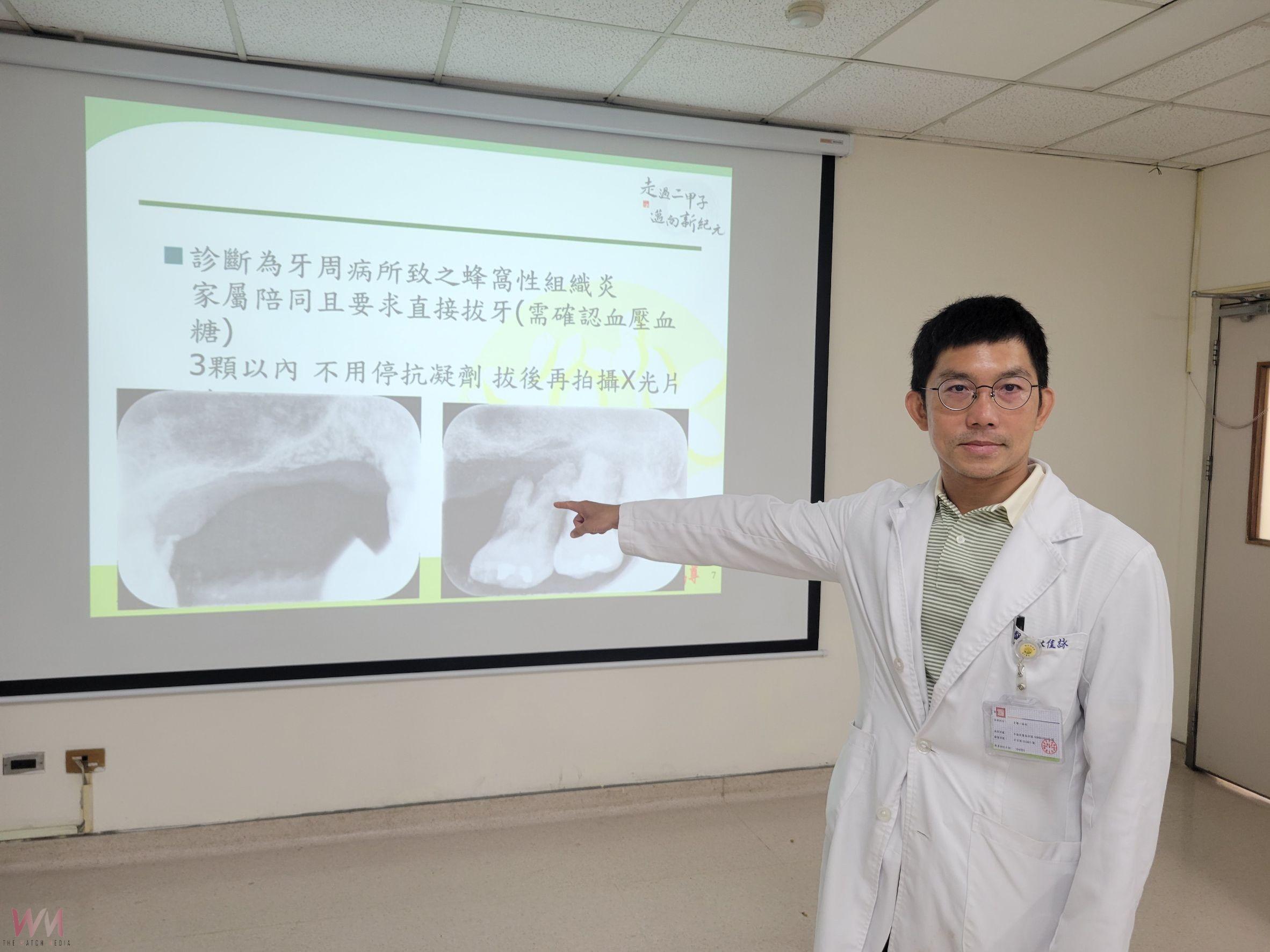 熱衷政治延誤治療!蛀牙菌惡化導致蜂窩性組織炎 臉腫發燒急就醫 - https://www.watchmedia01.com