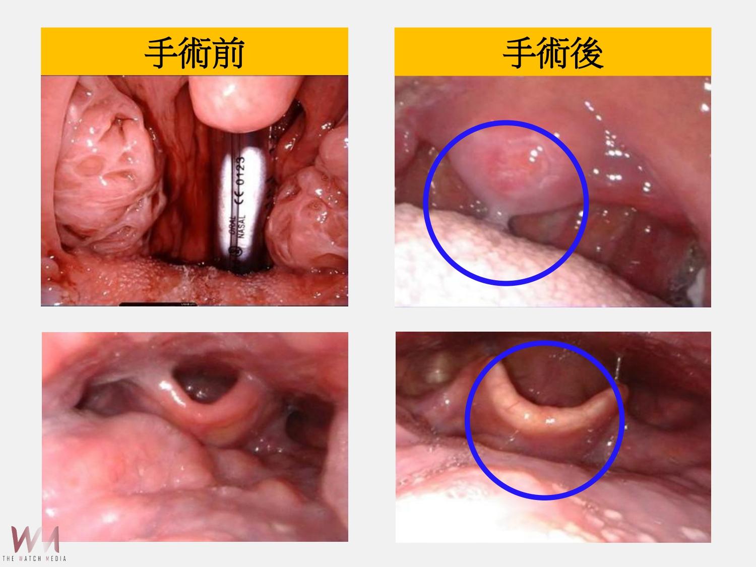 擺脫睡眠障礙困擾　達文西手術提供治療新選擇 大幅提升生活品質 - https://www.watchmedia01.com