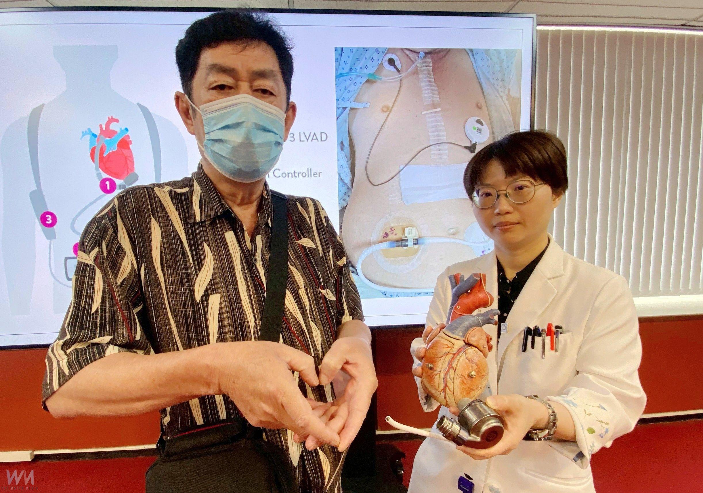 心臟功能剩不到兩成 中榮醫:植入式長效型左心室輔助器神救援 - https://www.watchmedia01.com