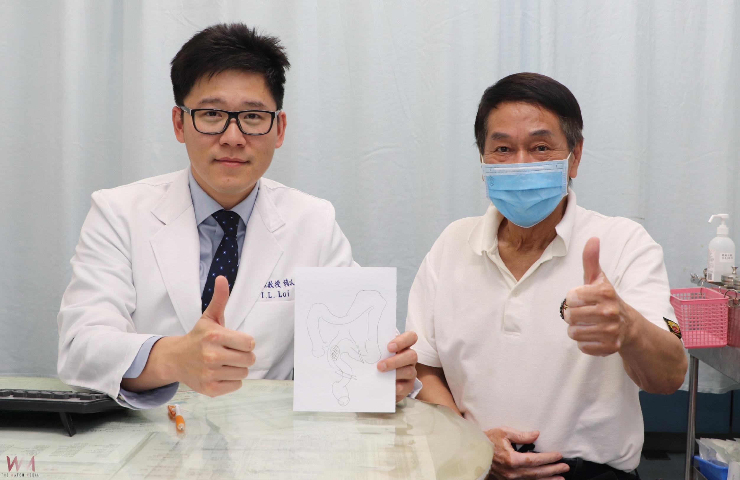 便血一年 檢查揪出直腸早期腺癌　仁愛長庚：達文西手術精準切除 - https://www.watchmedia01.com