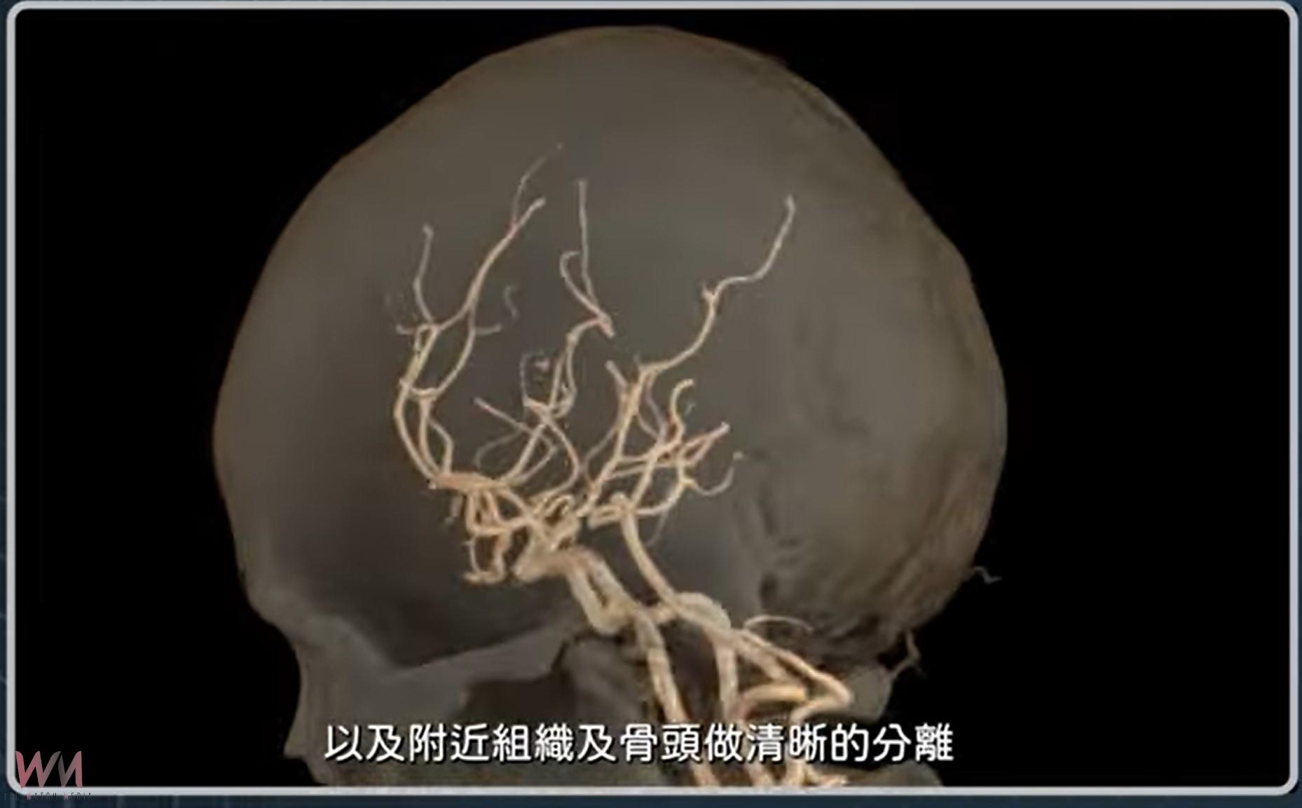 （有影片）／成大醫院256切高階CT落戶雲林　癌症心血管等檢查更快速精準 - https://www.watchmedia01.com