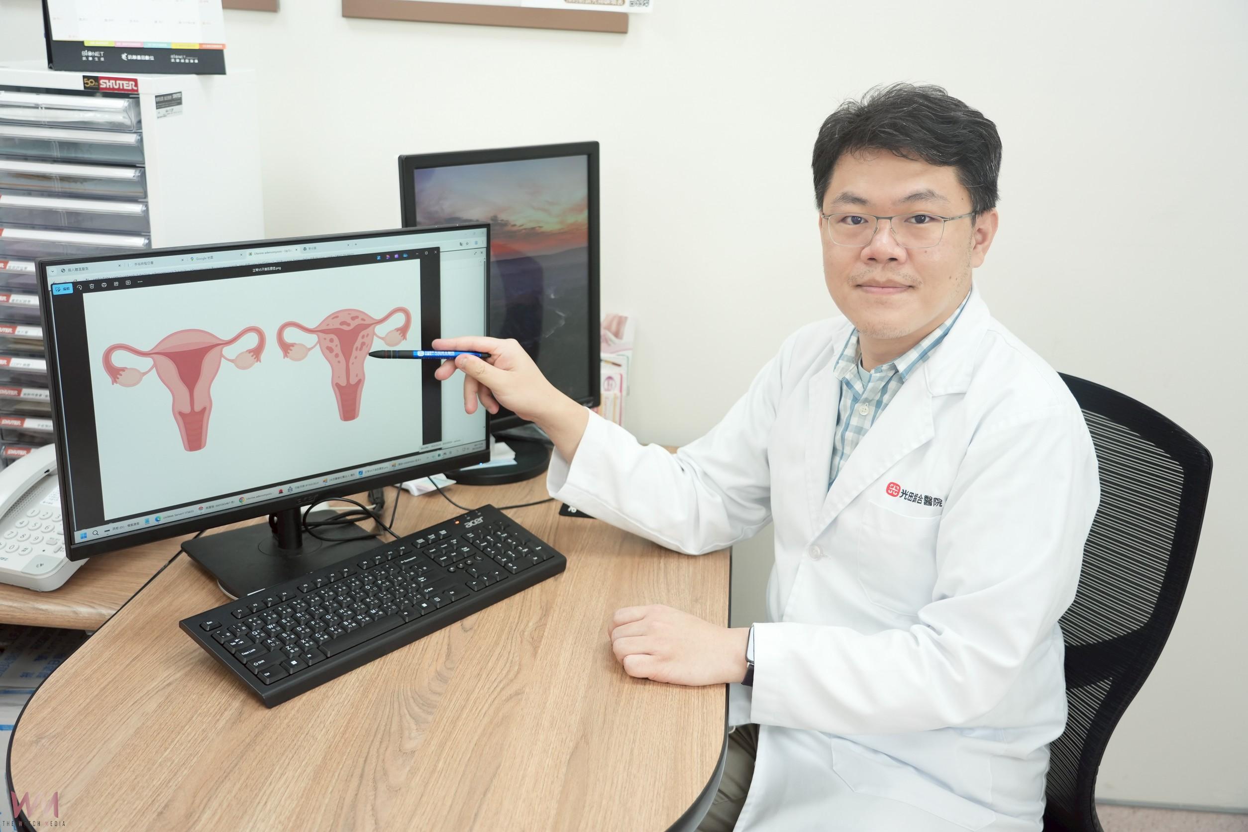 經痛到受不了?經血多恐藏子宮肌腺症 光田醫:達文西手術助脫困 - https://www.watchmedia01.com