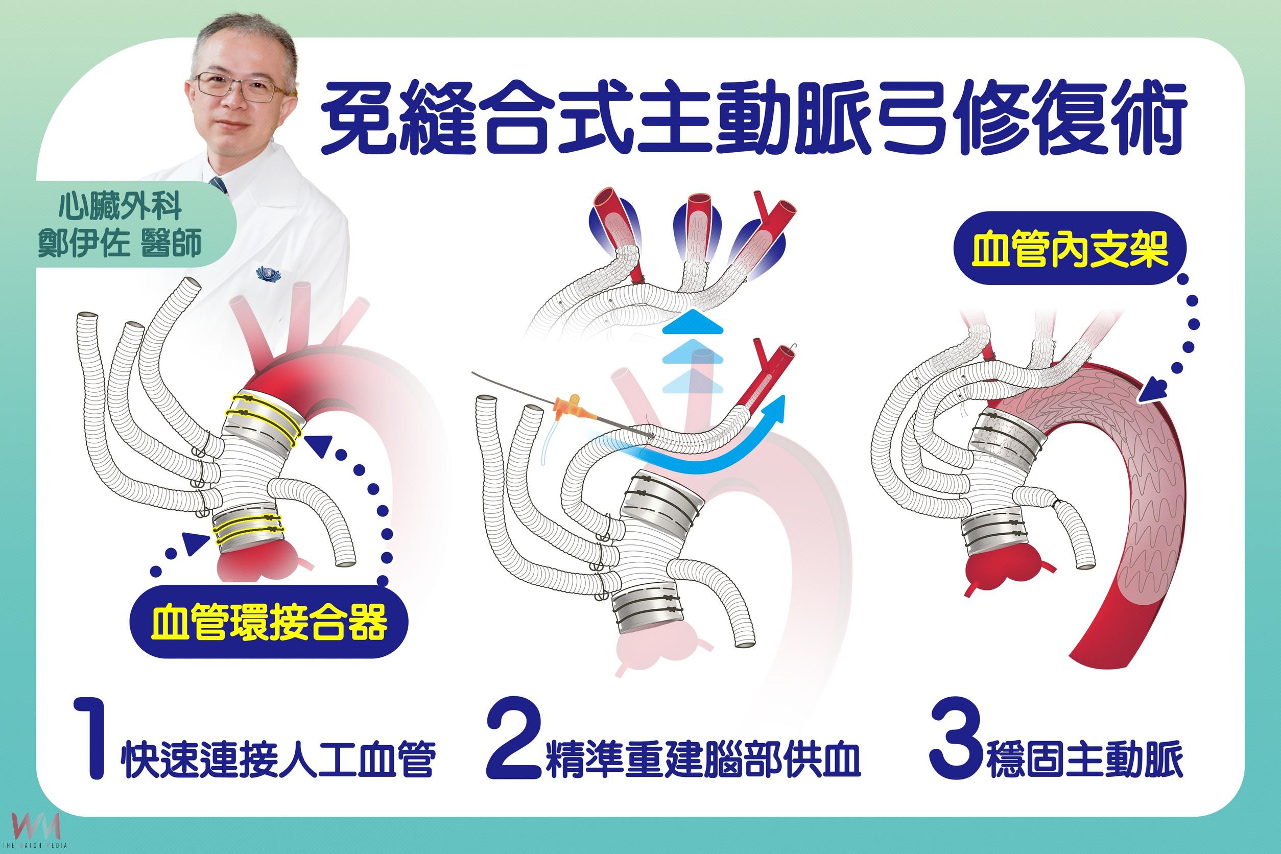 臺灣之光！免縫合式主動脈弓混合型手術　台中慈濟醫院獲亞洲首獎 - https://www.watchmedia01.com