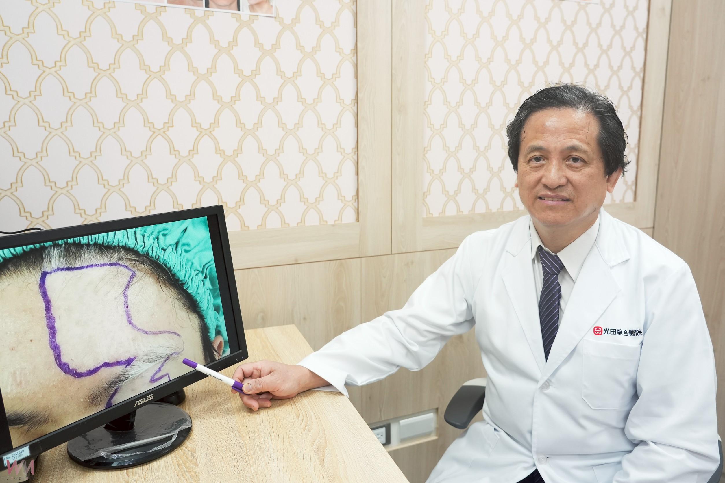 20歲少年戴帽兩年 同儕異樣眼光讓他「不敢抬頭」 醫生助恢復自信 - https://www.watchmedia01.com