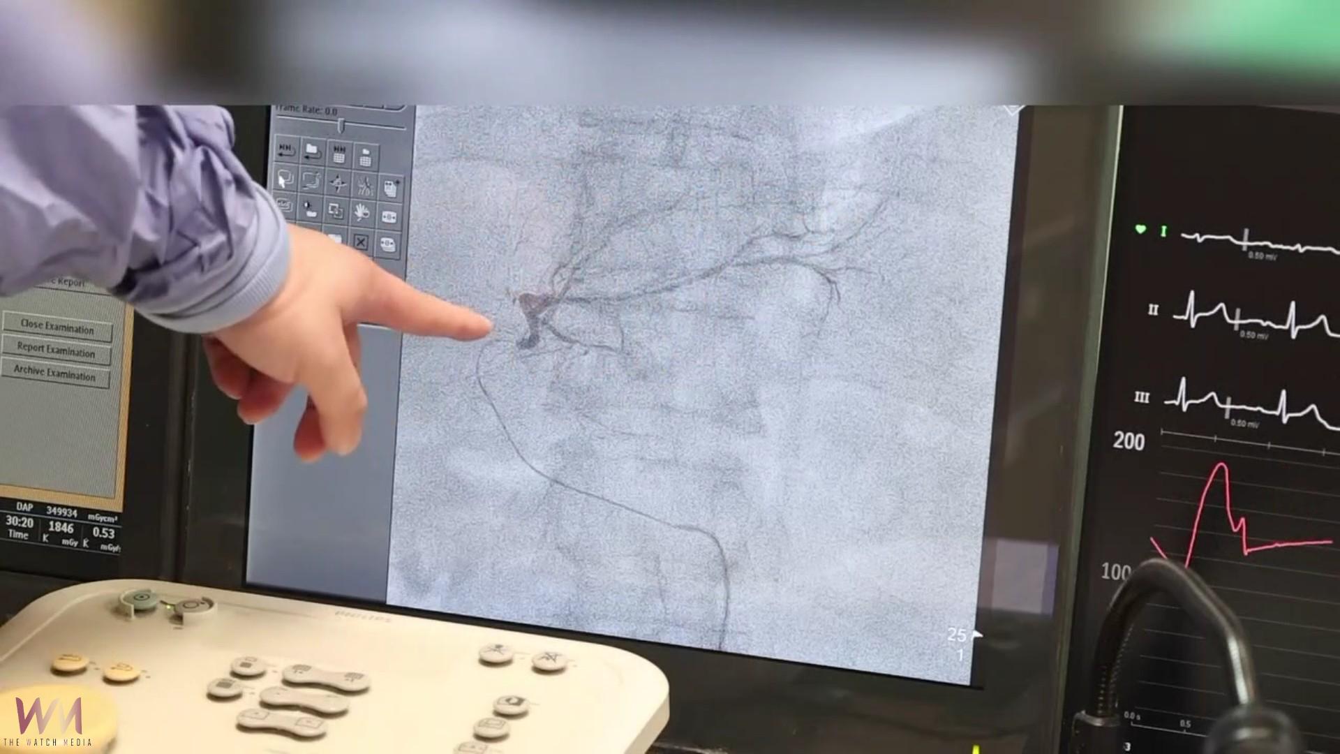 （有影片）／54歲B肝帶原者肝癌復發　員榮醫院TACE治療成功 - https://www.watchmedia01.com