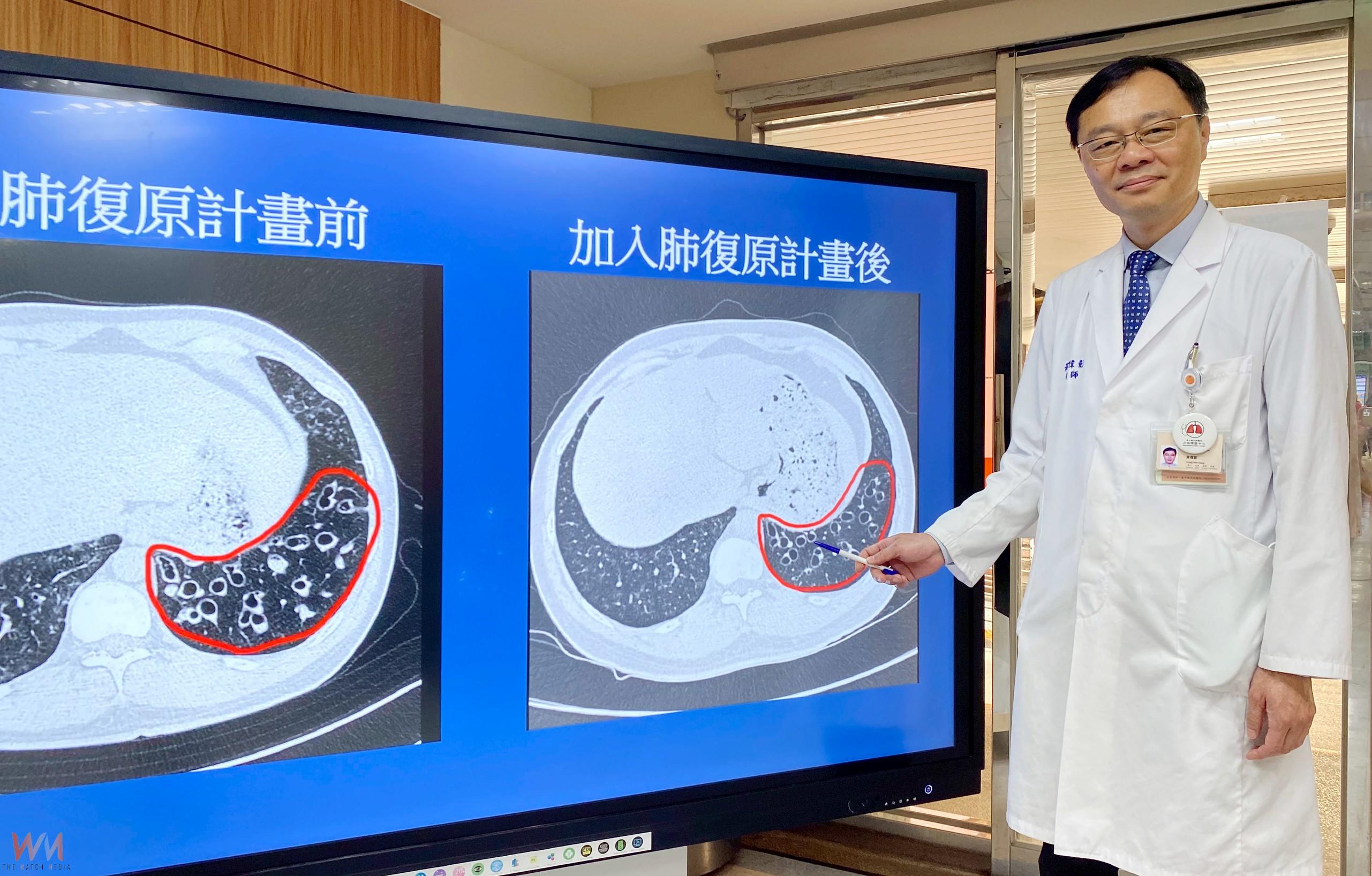 臺中榮總成立「呼吸道疾病整合照護中心」　助病人順暢每一口呼吸 - https://www.watchmedia01.com