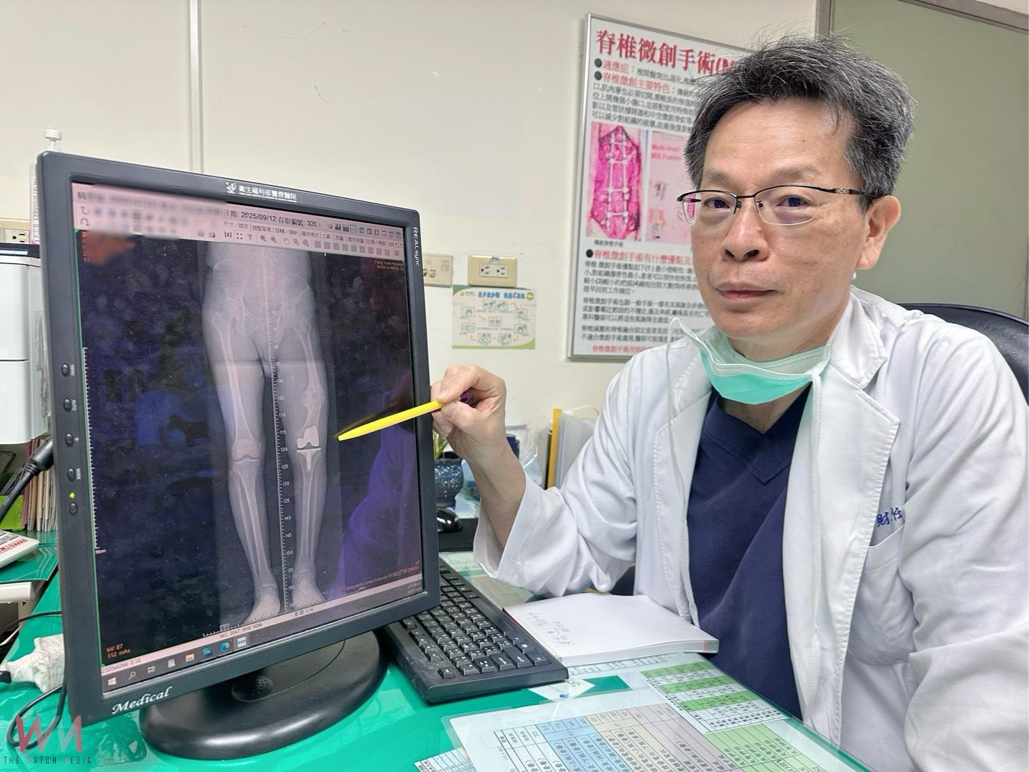 87歲翁長短腳一跛數十年 豐原醫:靠精準關節手術重拾穩健步態 - https://www.watchmedia01.com