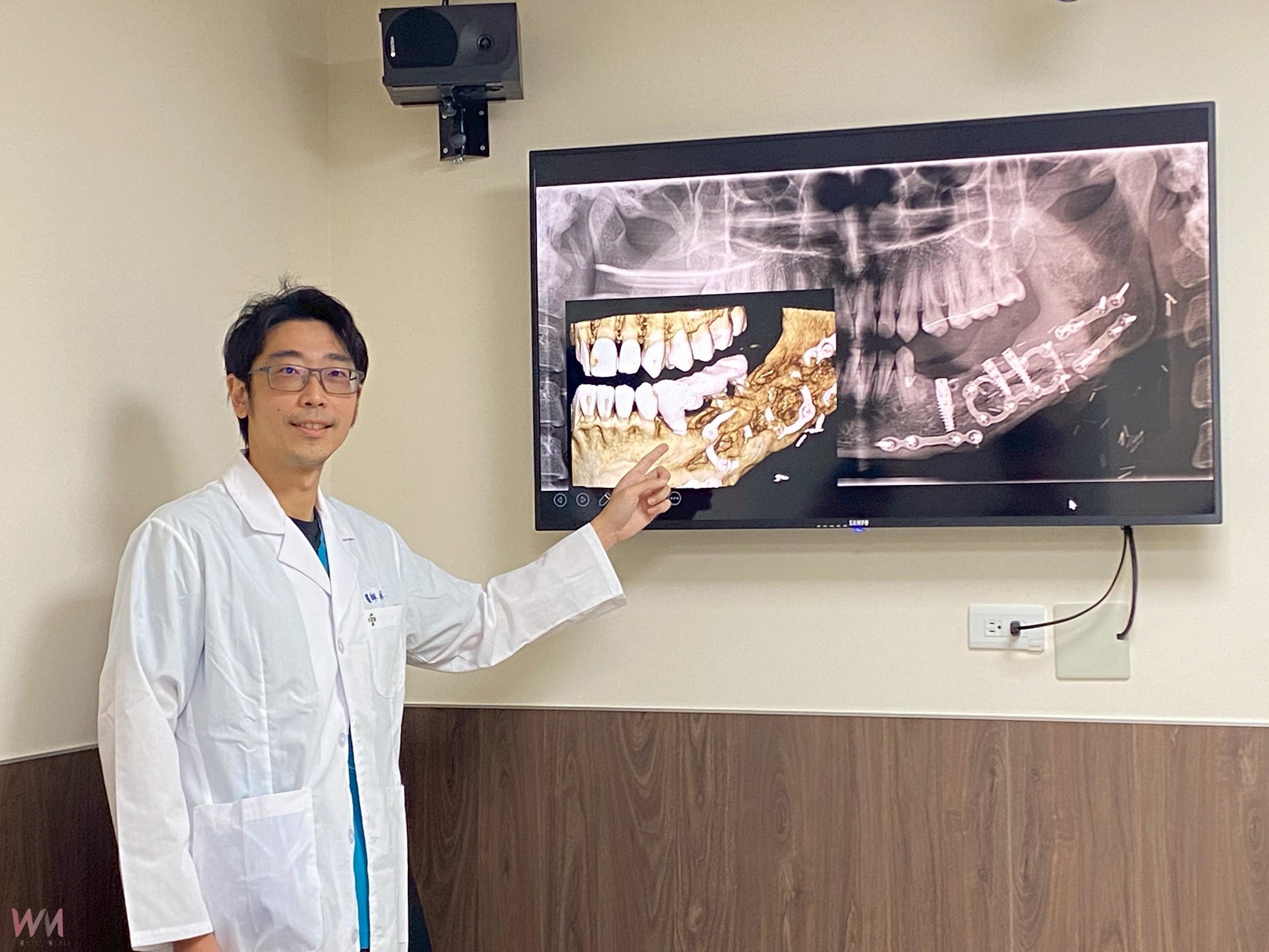 (有影片)/3D列印+ALL-ON-X!18歲少女下顎腫瘤精準重建成功 - https://www.watchmedia01.com