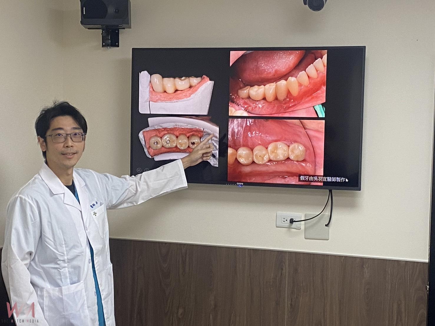 (有影片)/3D列印+ALL-ON-X!18歲少女下顎腫瘤精準重建成功 - https://www.watchmedia01.com