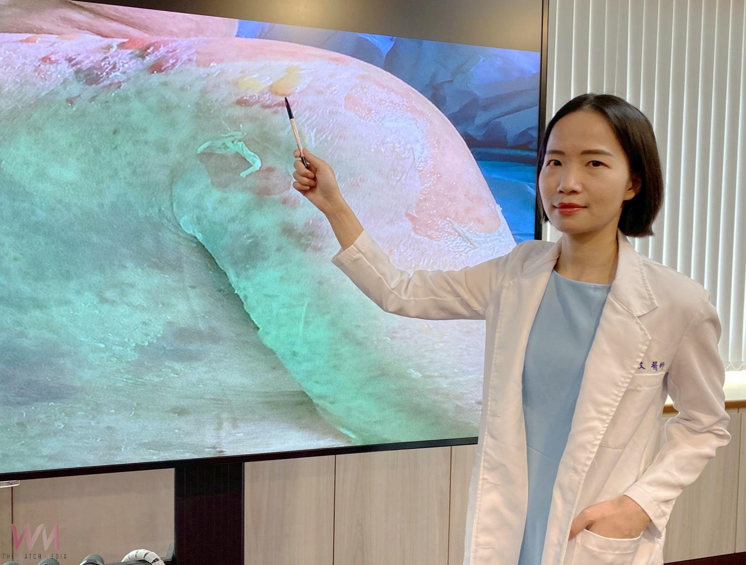 臺中榮總大數據研究揭示：嚴重藥物過敏者 患自體免疫疾病風險增5.6倍 - https://www.watchmedia01.com