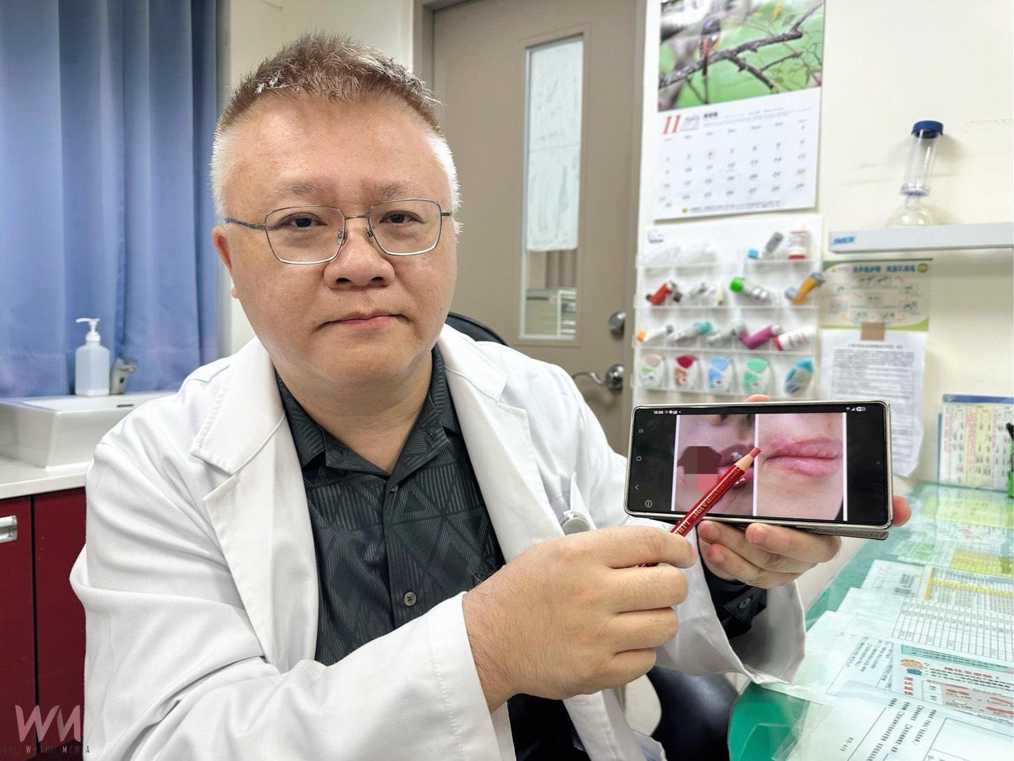 妙齡女被愛犬咬掉嘴邊肉 靠PRP增生療法促進細胞修復搶救成功 - https://www.watchmedia01.com