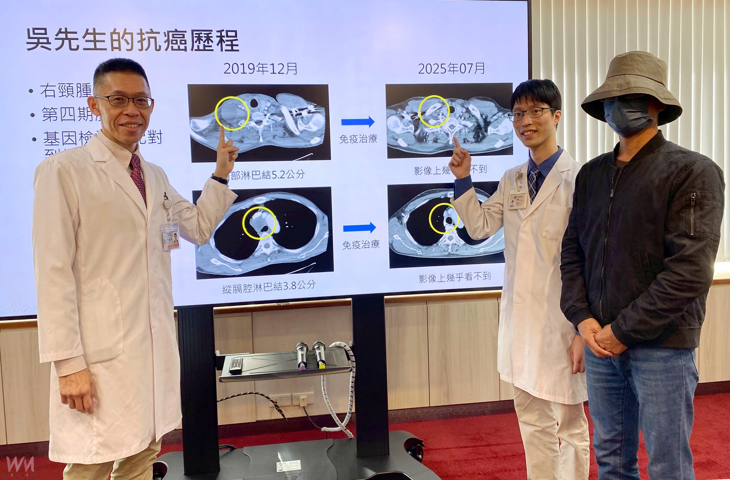 精準醫療改寫肺癌命運 四期病人存活逾6年 扭轉絕望為希望 - https://www.watchmedia01.com