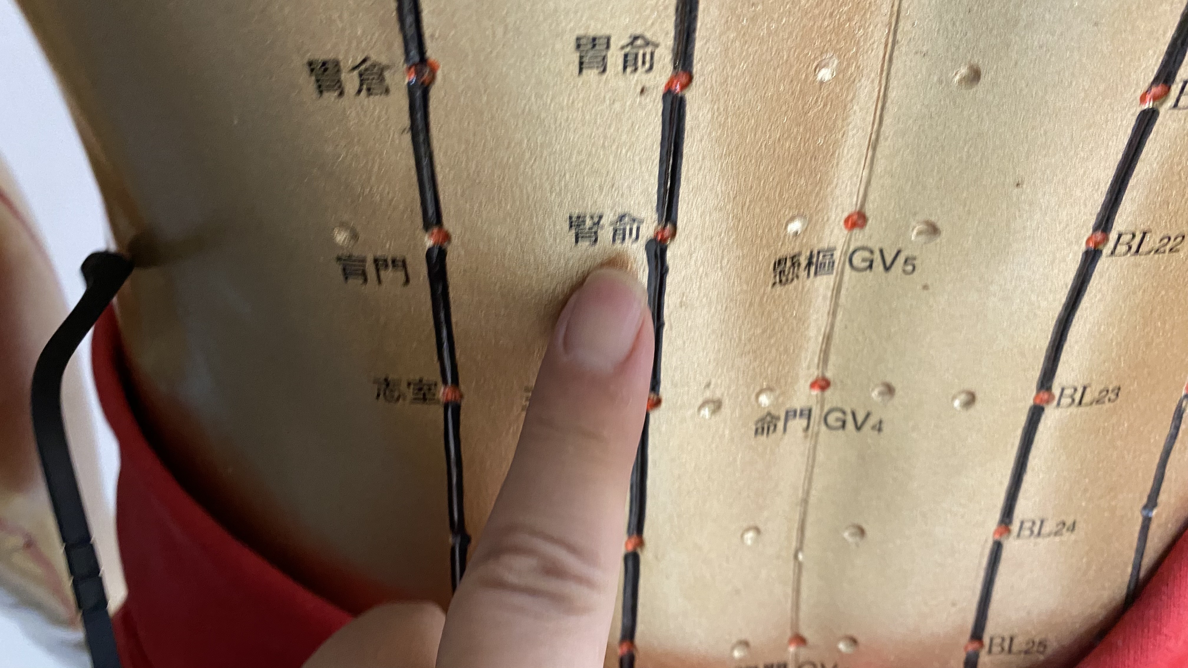 中藥調理搭配針灸及西醫監測　延緩慢性腎病惡化 - https://www.watchmedia01.com