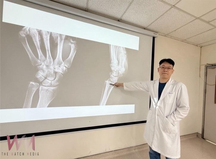 排球妹救球飛撲落地韌帶撕裂傷 PRP合併復位手術助她重返球場 - https://www.watchmedia01.com