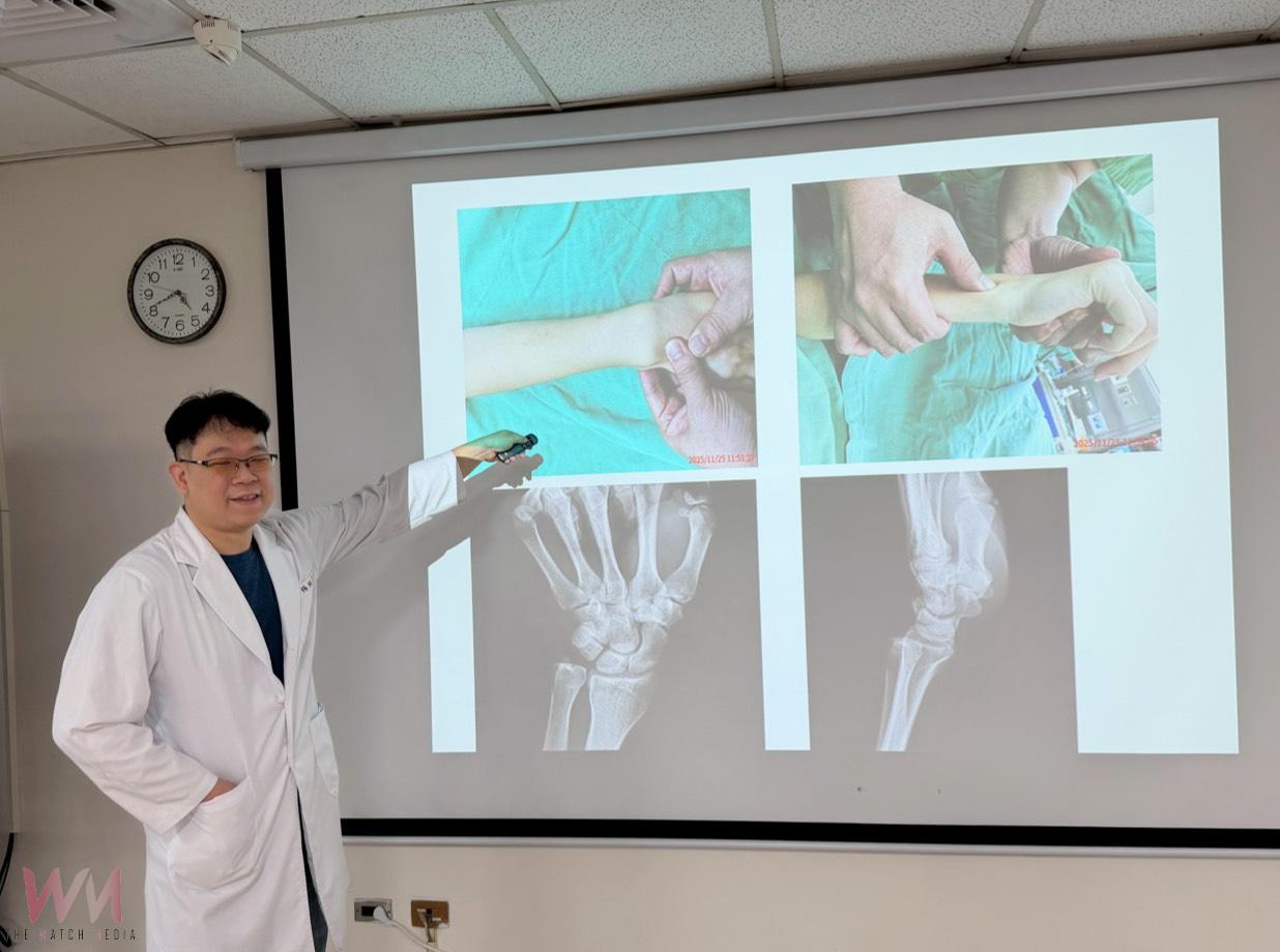 排球妹救球飛撲落地韌帶撕裂傷 PRP合併復位手術助她重返球場 - https://www.watchmedia01.com