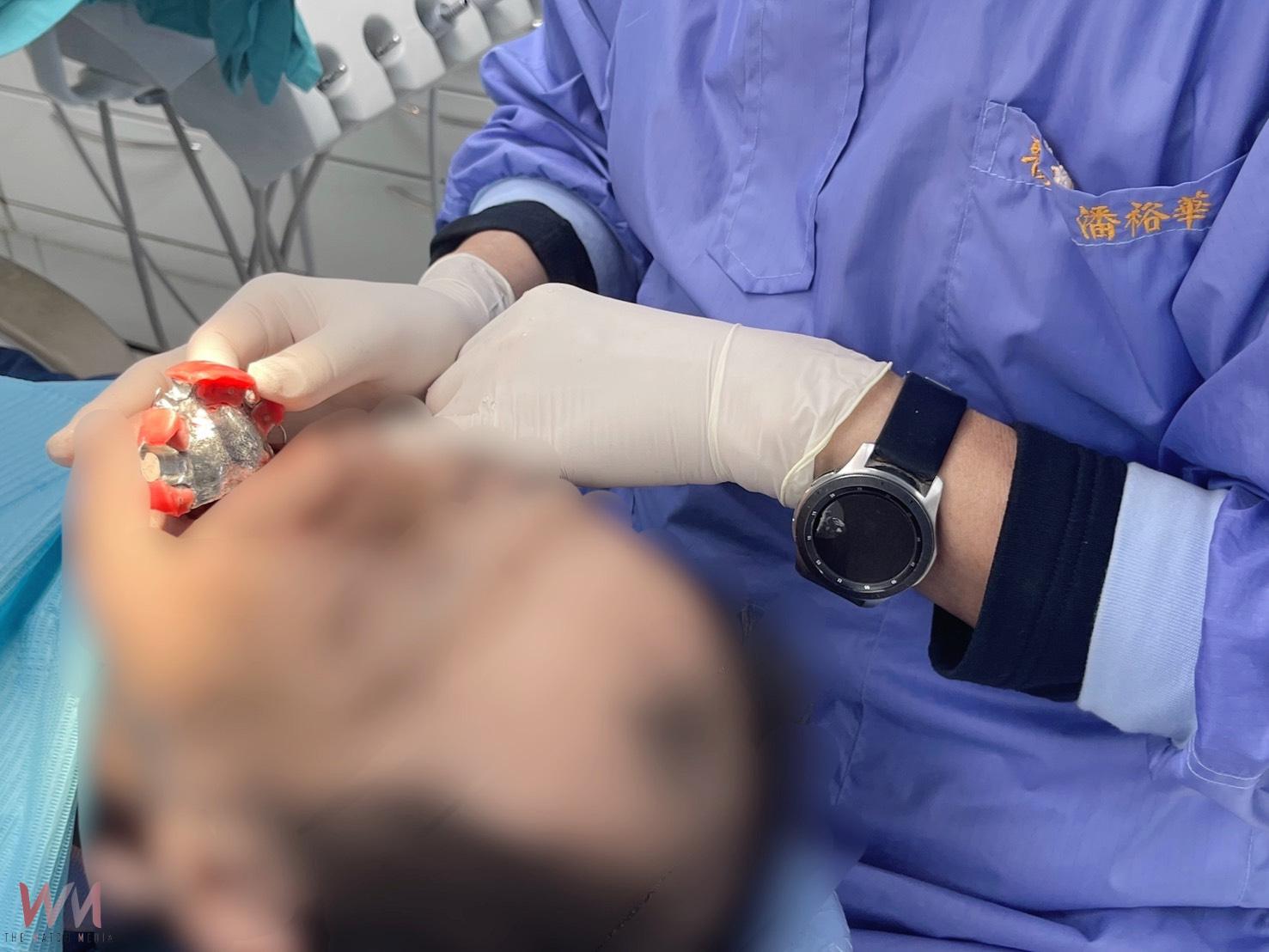 僅能張口2公分！中山附醫導入「數位口掃」技術　口腔癌患者重建功能展笑容 - https://www.watchmedia01.com