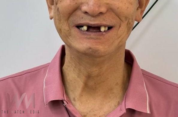 7天逆轉多年牙周病　光田醫院：全口重建助台商重拾自信與活力 - https://www.watchmedia01.com