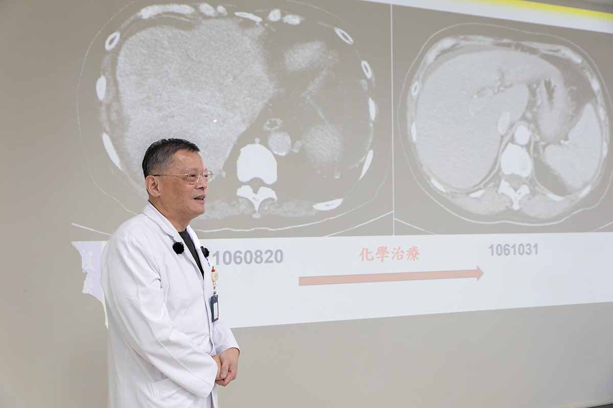 肝癌末期腫瘤不見了!陽明交大附醫「個別化治療」創奇蹟 - https://www.watchmedia01.com