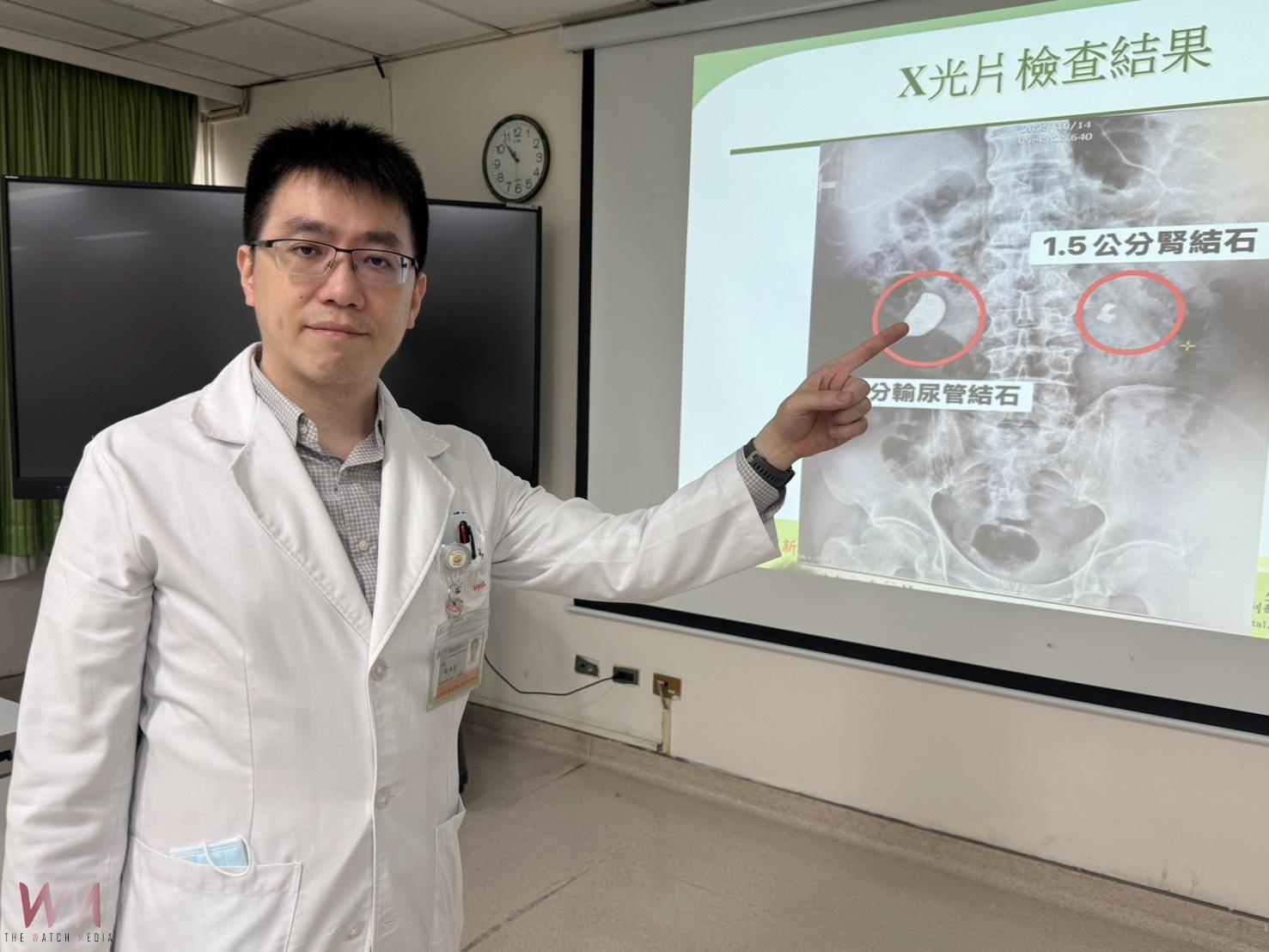 驚！男腰痠血尿就醫 右輸尿與左腎赫見大結石　緊急取石手術、震波碎石治療 - https://www.watchmedia01.com