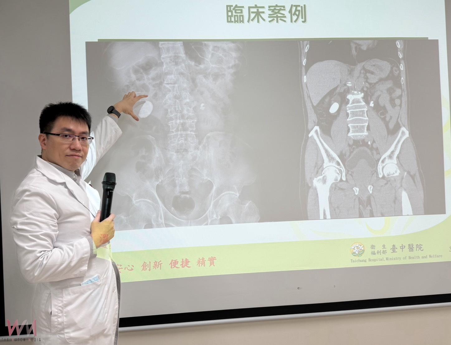 驚！男腰痠血尿就醫 右輸尿與左腎赫見大結石　緊急取石手術、震波碎石治療 - https://www.watchmedia01.com