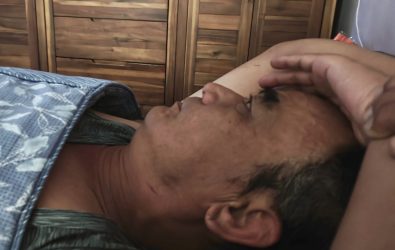林姓男子近期常在睡夢中大聲吼叫、拳打腳踢，甚至多次無意間揮拳打到枕邊太太，曾因動作劇烈滾下床，醫師診斷竟是睡眠障礙作祟。（示意圖 秀傳醫院提供）